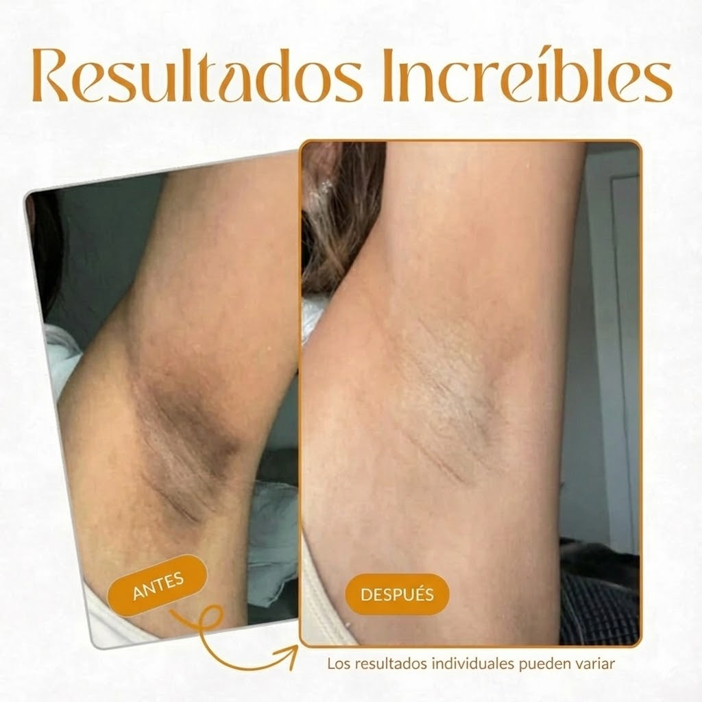 Spray Exfoliante - Aclarador Corporal