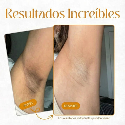 Spray Exfoliante - Aclarador Corporal